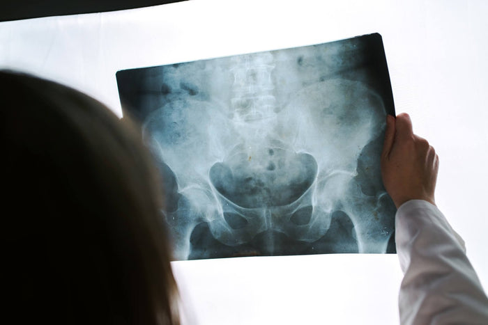Dolor de cadera: causas, tratamientos y la innovación de la terapia celular