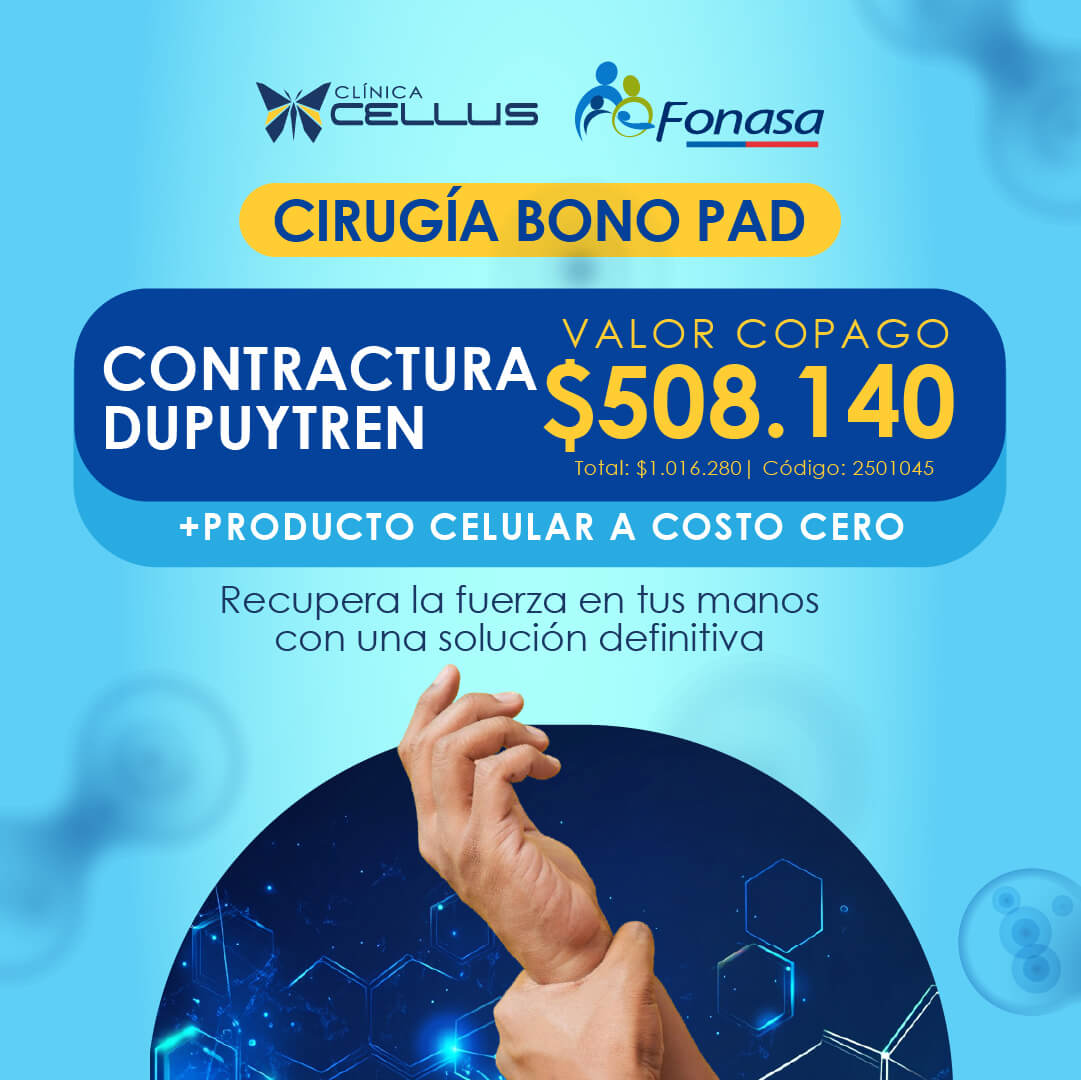 Cirugía Bono PAD — contractura de Dupuytren