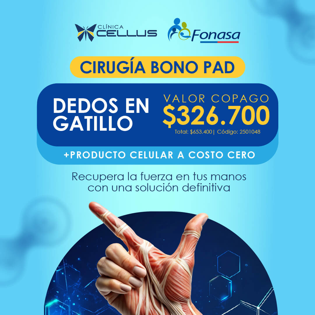 Cirugía Bono PAD — dedo en gatillo