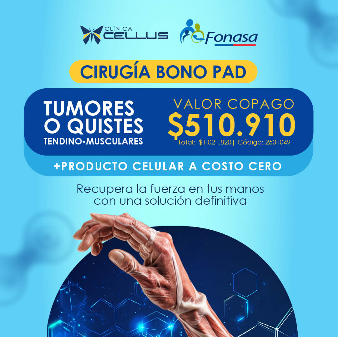 Cirugía Bono PAD — tumores de partes blandas