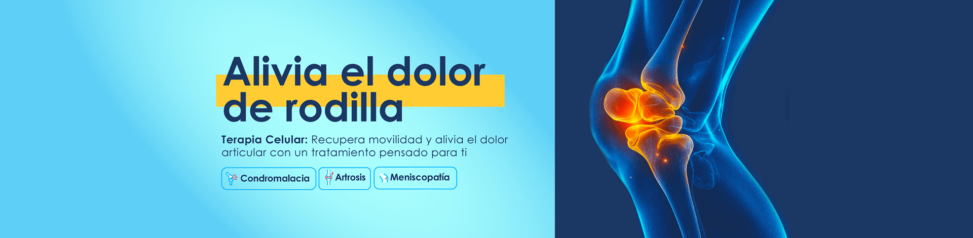 Tratamientos para dolor de rodilla