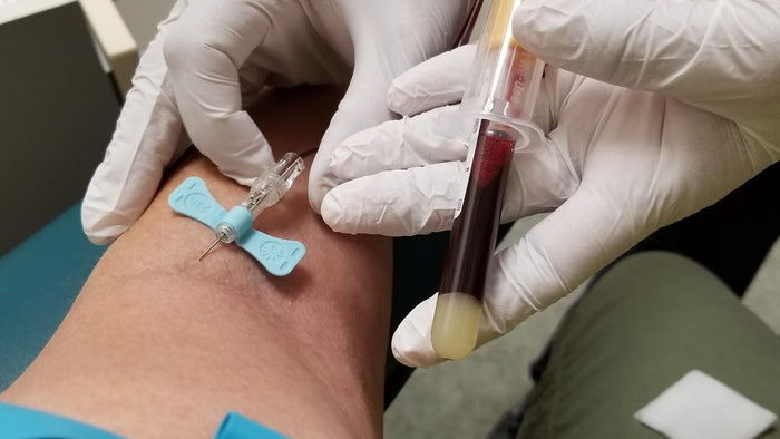 Epicondilitis: Causas, diagnóstico y tratamiento